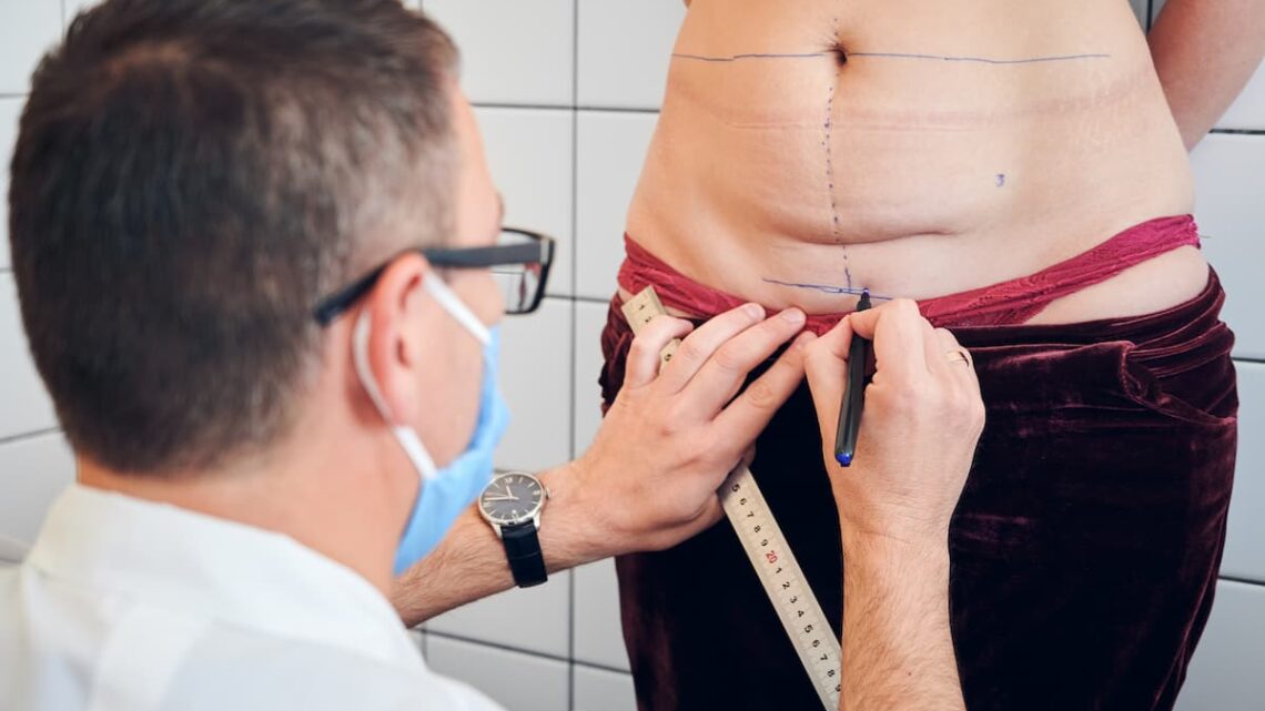 Abdominoplastie Tunisie : comparaison des prix et avantages, guide complet