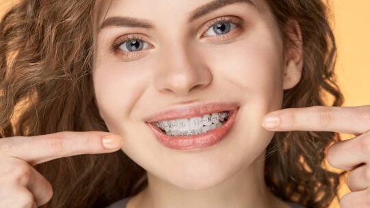 Guide complet remplacement et retrait d’appareils orthodontiques