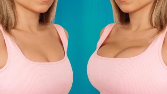 Lifting des seins vs Augmentation mammaire : Choisir la bonne opération pour vous