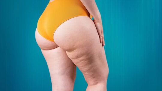 Chirurgie esthétique cuisses et fesses : guide complet et tarifs