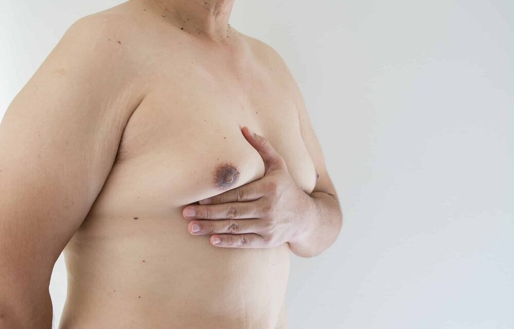 La chirurgie esthétique des seins hypertrophes chez les hommes : Traiter la gynécomastie